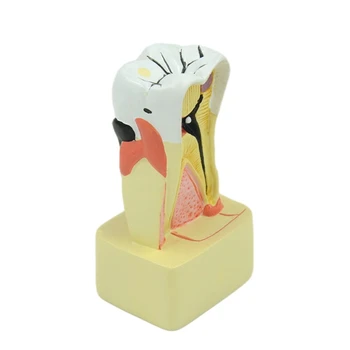 Пародонтальный анализ Модели зубов G5AA Dental для общения врача и пациента